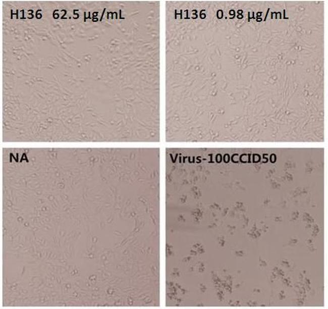 Enterovirus 71 VP1 Antibody in Neutralization (Neu)