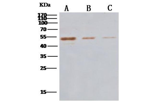 MERS Coronavirus NP Antibody in Western Blot (WB)
