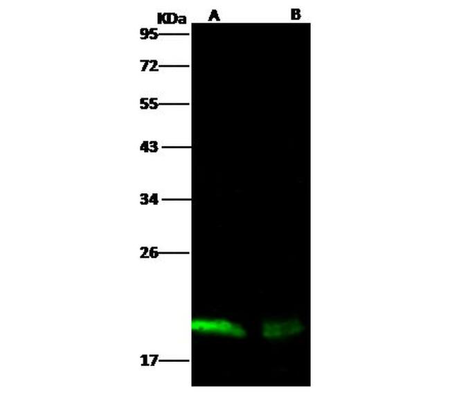 Ebola Virus NP (subtype Zaire, strain H.sapiens-wt/GIN/2014/Kissidougou-C15) Antibody in Western Blot (WB)