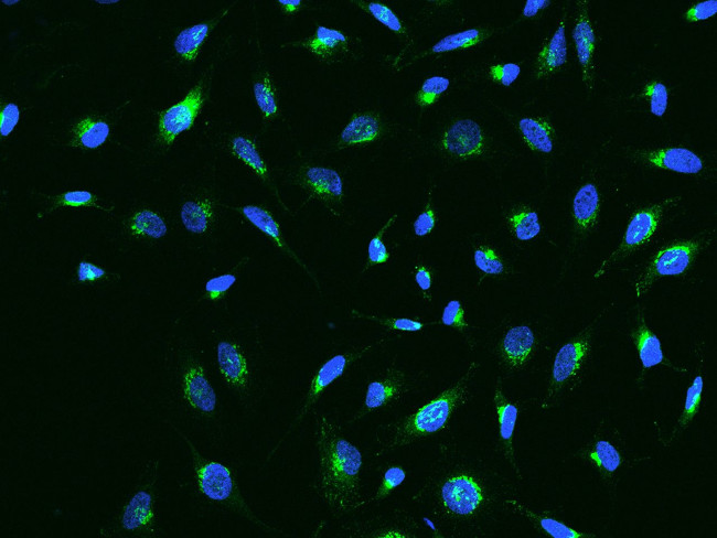 IGFBP7 Antibody in Immunocytochemistry (ICC/IF)