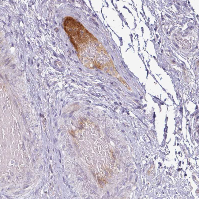 Apolipoprotein L1 Antibody in Immunohistochemistry (Paraffin) (IHC (P))