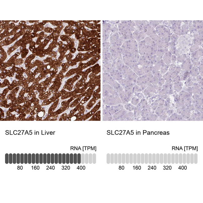 SLC27A5 Antibody in Immunohistochemistry (Paraffin) (IHC (P))