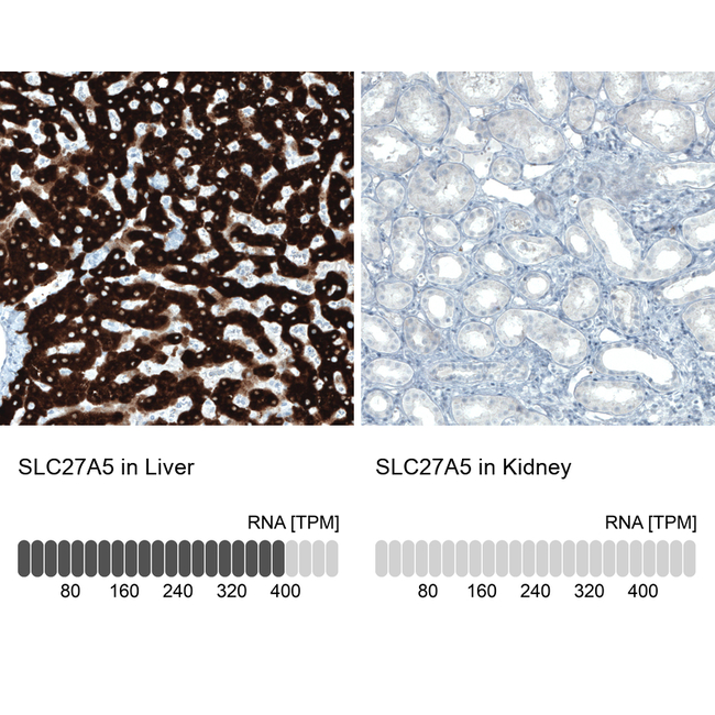 SLC27A5 Antibody in Immunohistochemistry (Paraffin) (IHC (P))