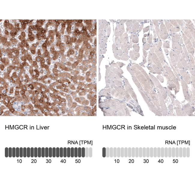 HMGCR Antibody in Immunohistochemistry (Paraffin) (IHC (P))