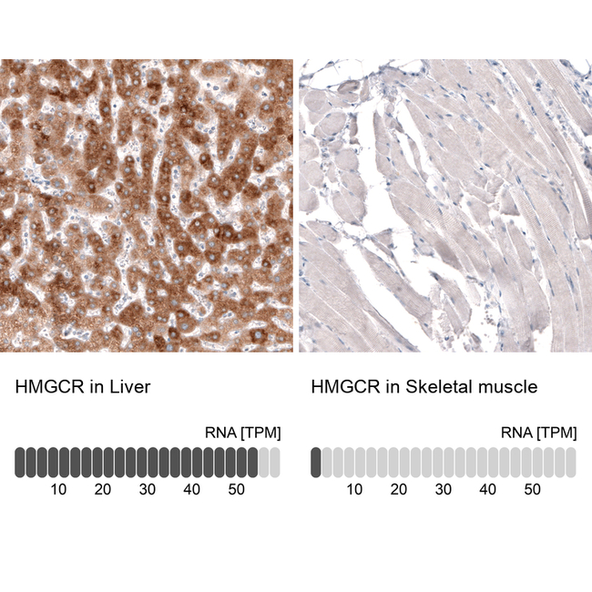 HMGCR Antibody in Immunohistochemistry (Paraffin) (IHC (P))