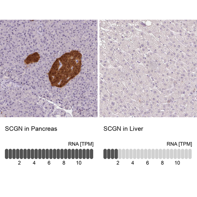 SCGN Antibody in Immunohistochemistry (Paraffin) (IHC (P))