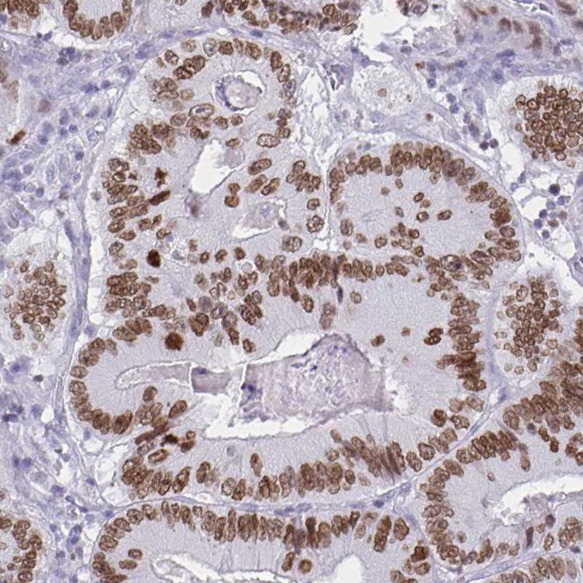 SATB2 Antibody in Immunohistochemistry (Paraffin) (IHC (P))