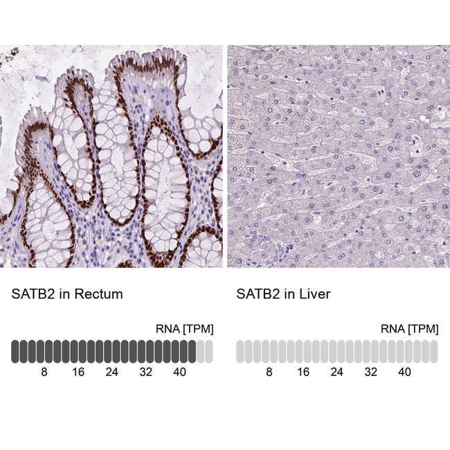 SATB2 Antibody in Immunohistochemistry (Paraffin) (IHC (P))