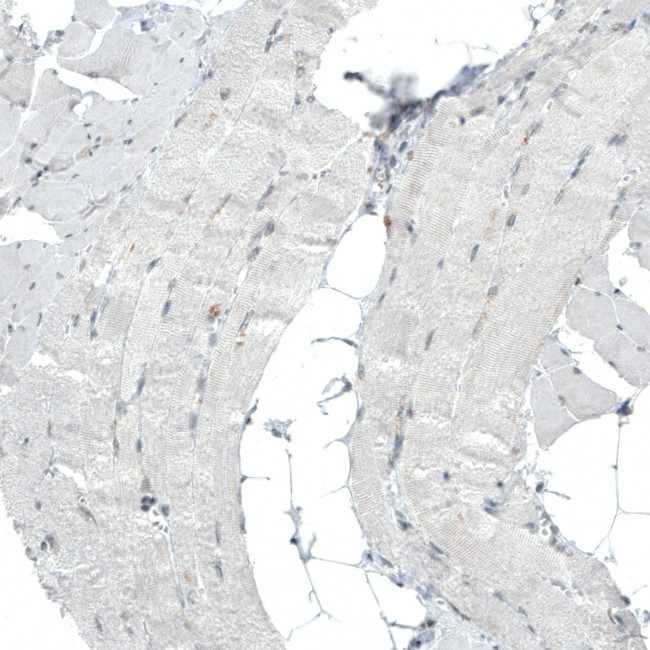 PBRM1 Antibody in Immunohistochemistry (Paraffin) (IHC (P))