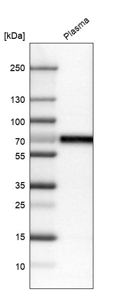 CNDP1 Antibody in Western Blot (WB)