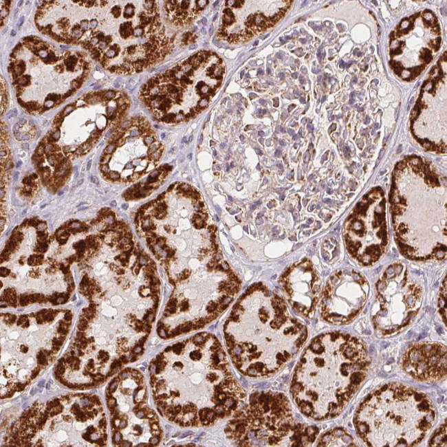 SDHB Antibody in Immunohistochemistry (Paraffin) (IHC (P))