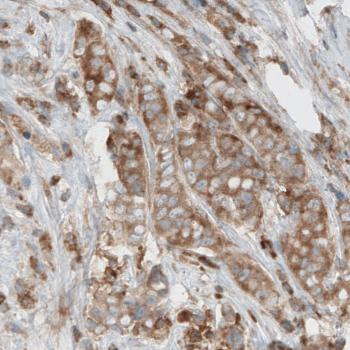 Dicer Antibody in Immunohistochemistry (Paraffin) (IHC (P))
