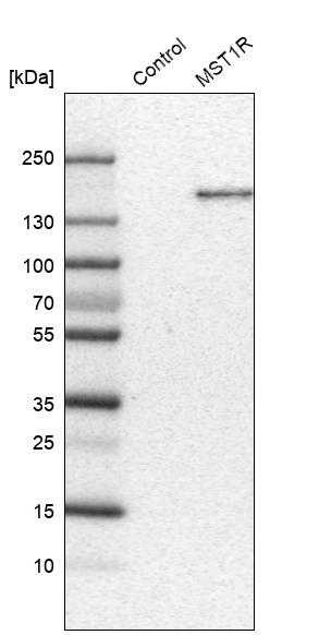 RON Antibody in Western Blot (WB)