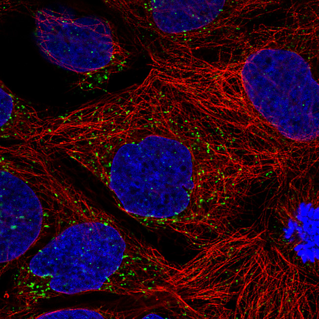 ACAA1 Antibody in Immunocytochemistry (ICC/IF)