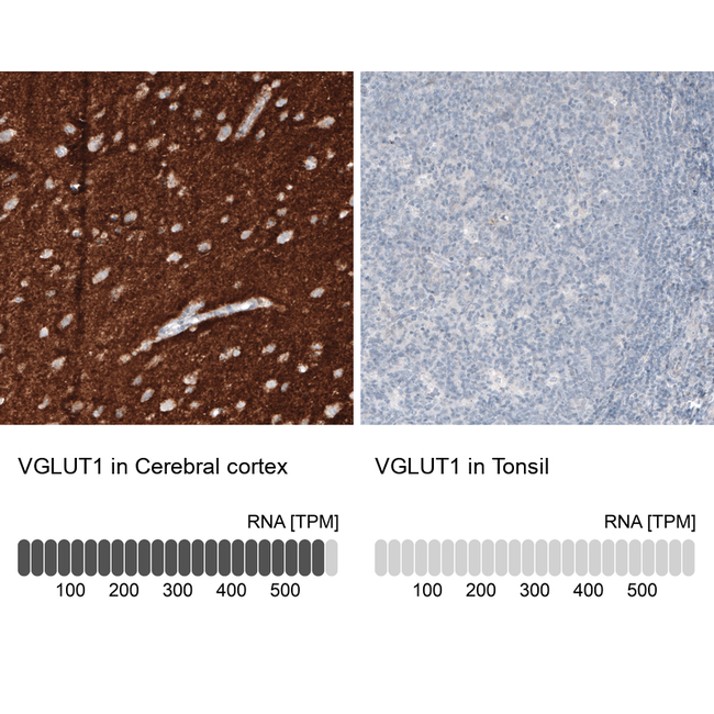 VGLUT1 Antibody in Immunohistochemistry (Paraffin) (IHC (P))