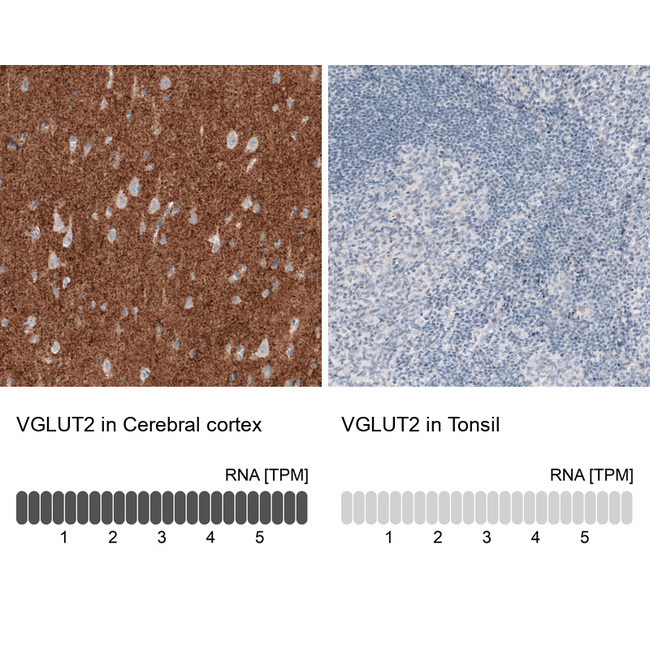 VGLUT2 Antibody in Immunohistochemistry (Paraffin) (IHC (P))