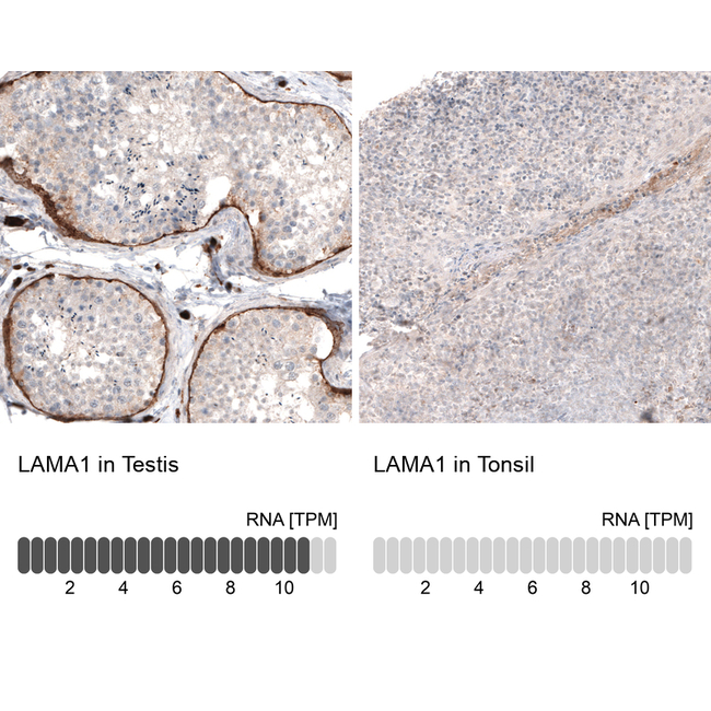 Laminin alpha-1 Antibody in Immunohistochemistry (Paraffin) (IHC (P))