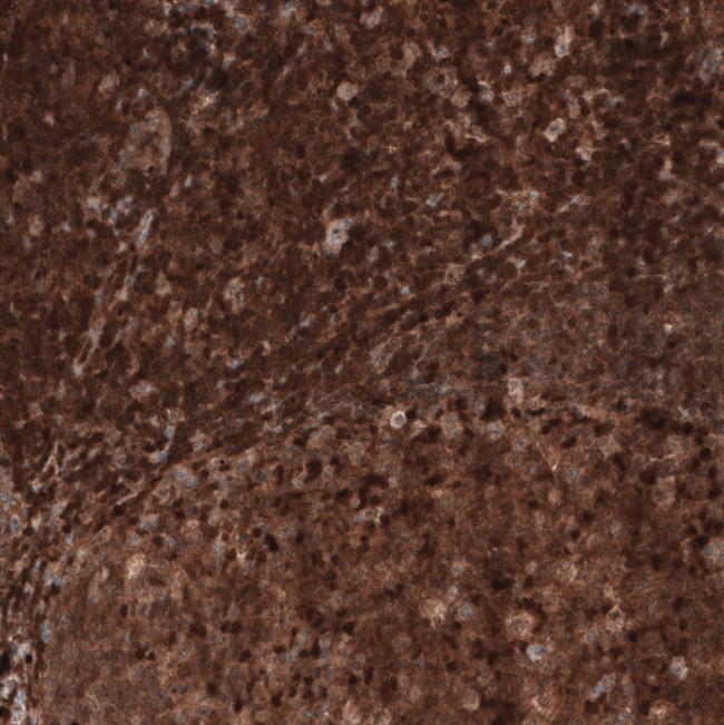 Profilin 1 Antibody in Immunohistochemistry (Paraffin) (IHC (P))