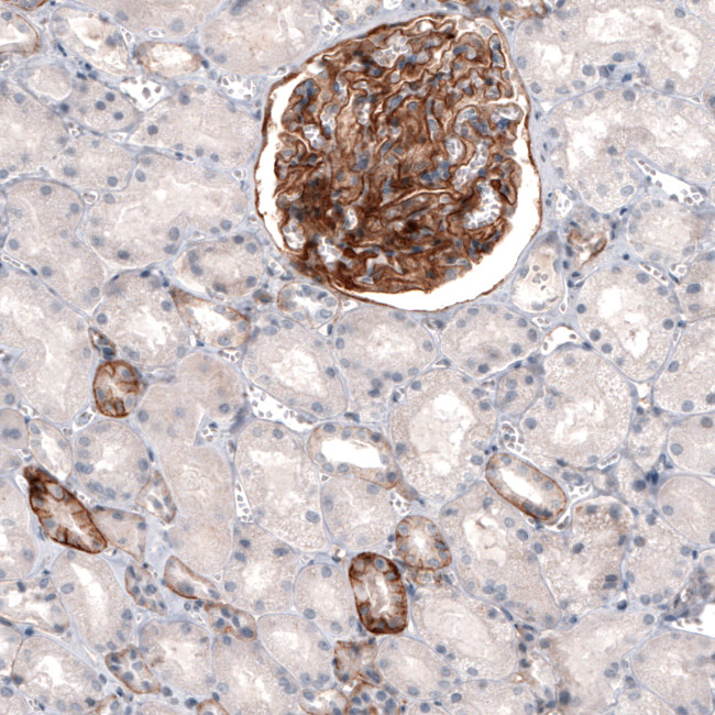 THSD7A Antibody in Immunohistochemistry (Paraffin) (IHC (P))