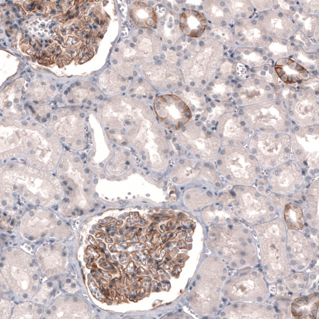 THSD7A Antibody in Immunohistochemistry (Paraffin) (IHC (P))