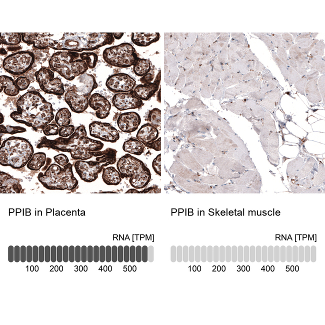 Cyclophilin B Antibody in Immunohistochemistry (Paraffin) (IHC (P))