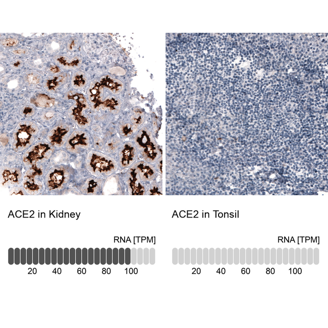 ACE2 Antibody in Immunohistochemistry (Paraffin) (IHC (P))