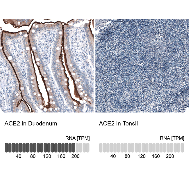 ACE2 Antibody in Immunohistochemistry (Paraffin) (IHC (P))