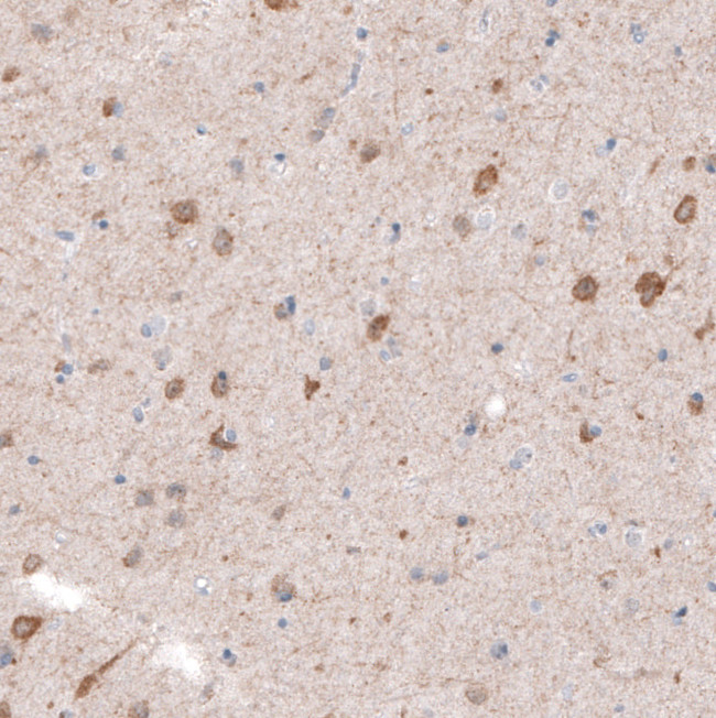 CDKL5 Antibody in Immunohistochemistry (Paraffin) (IHC (P))