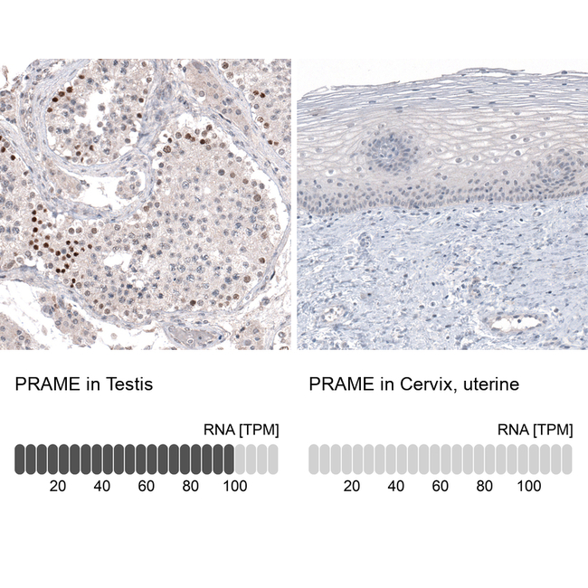 PRAME Antibody in Immunohistochemistry (Paraffin) (IHC (P))
