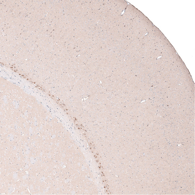 CTGF Antibody in Immunohistochemistry (Paraffin) (IHC (P))