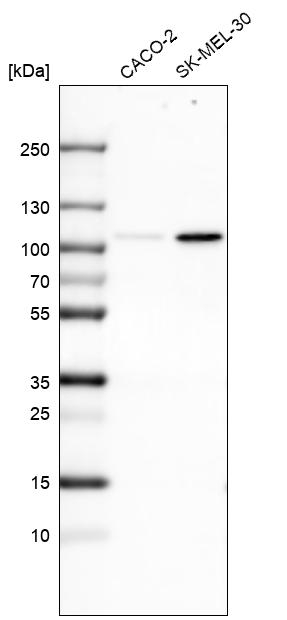 SOX6 Antibody in Western Blot (WB)