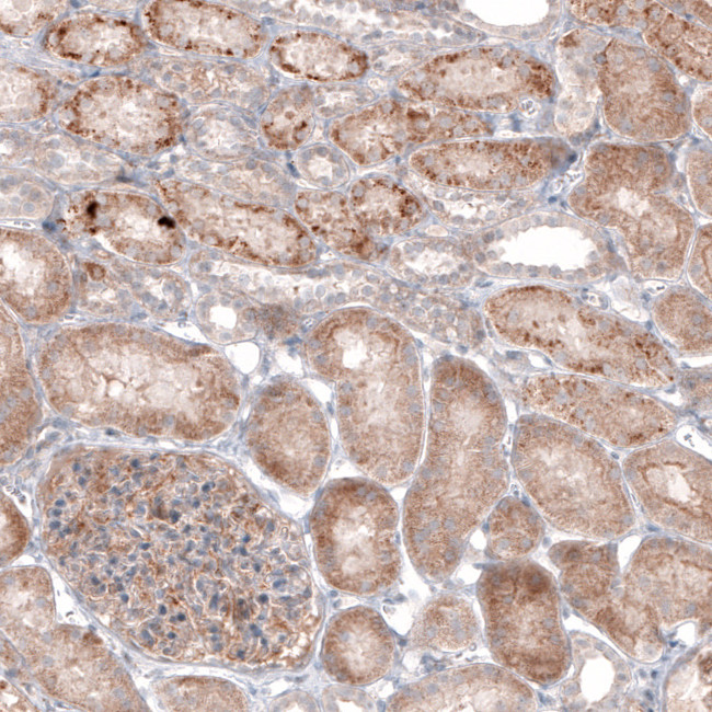 G6PC Antibody in Immunohistochemistry (Paraffin) (IHC (P))
