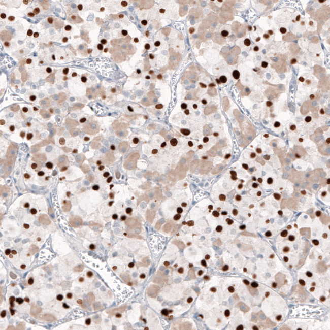 TBX19 Antibody in Immunohistochemistry (Paraffin) (IHC (P))