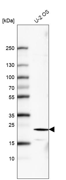 FGF21 Antibody in Western Blot (WB)