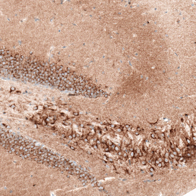 Sortilin Antibody in Immunohistochemistry (Paraffin) (IHC (P))