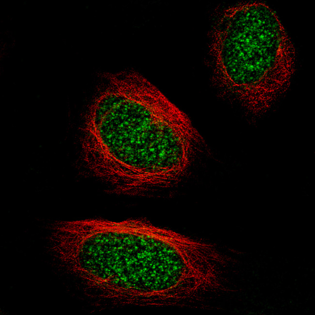 TET2 Antibody in Immunocytochemistry (ICC/IF)