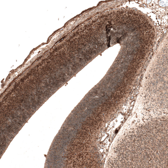 AUTS2 Antibody in Immunohistochemistry (Paraffin) (IHC (P))