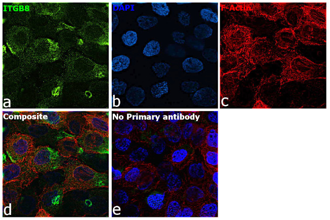 ITGB8 Antibody in Immunocytochemistry (ICC/IF)