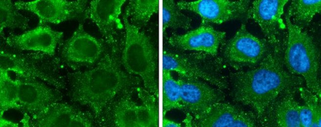 GLO1 Antibody in Immunocytochemistry (ICC/IF)