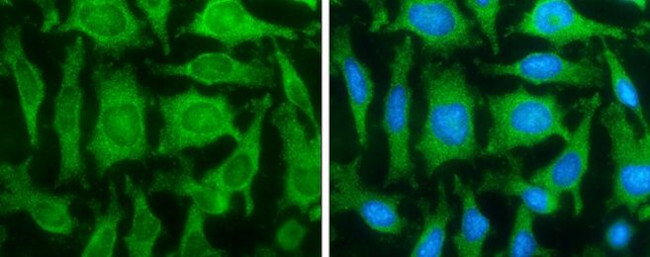 FASN Antibody in Immunocytochemistry (ICC/IF)