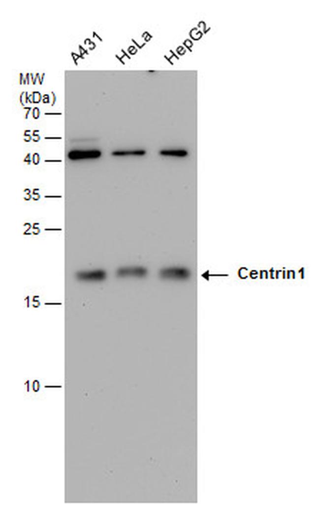 Centrin 1 Antibody in Western Blot (WB)