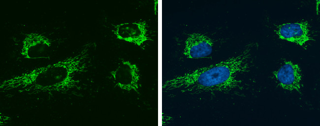 Glutaminase C (GAC) Antibody in Immunocytochemistry (ICC/IF)