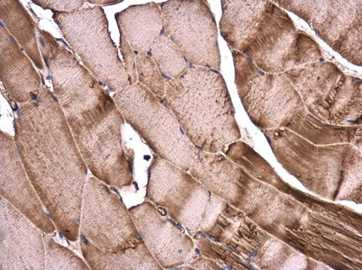 alpha Actinin 2 Antibody in Immunohistochemistry (Paraffin) (IHC (P))
