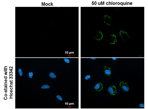 LC3B Antibody in Immunocytochemistry (ICC/IF)