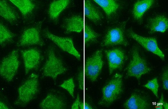 Gelsolin Antibody in Immunocytochemistry (ICC/IF)