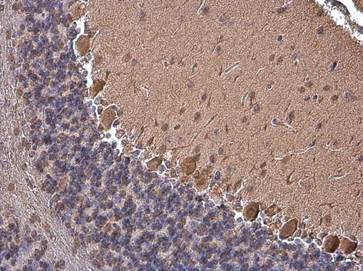 Phospho-p130Cas (Tyr249) Antibody in Immunohistochemistry (Paraffin) (IHC (P))
