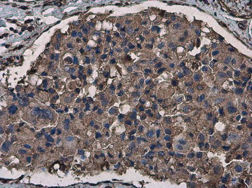 Phospho-Vimentin (Ser56) Antibody in Immunohistochemistry (Paraffin) (IHC (P))