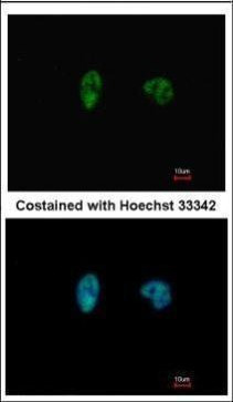 CHK2 Antibody in Immunocytochemistry (ICC/IF)