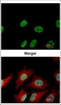 Ku70 Antibody in Immunocytochemistry (ICC/IF)