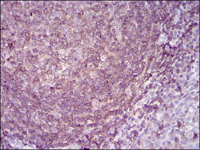 RIAM Antibody in Immunohistochemistry (Paraffin) (IHC (P))